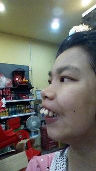 吃瓜大龅牙,揭秘娱乐圈的“瓜王”传奇